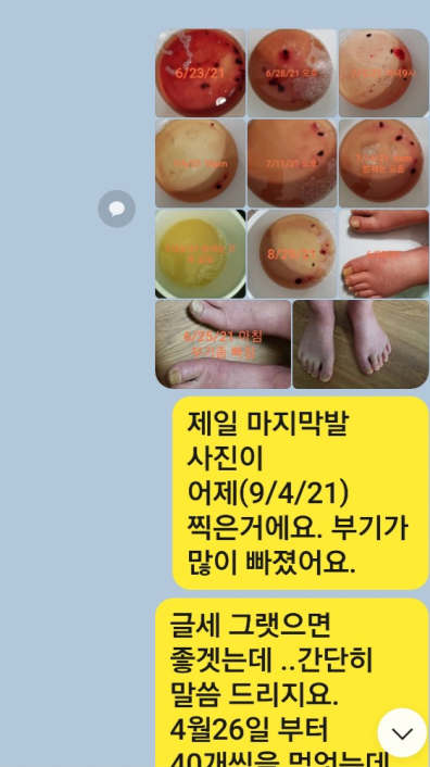 텔로유스, 텔로유스 당뇨 발 , 텔로유스 혈액순환, 텔로유스 말기암,미국텔로유스,엘에이 텔로유스,la 텔로유스,한국 텔로유스,텔로유스 무좀, 텔로유스 청력회복, 텔로유스 신장 대장 오장육부,텔로유스 소화장애 변비 789.png