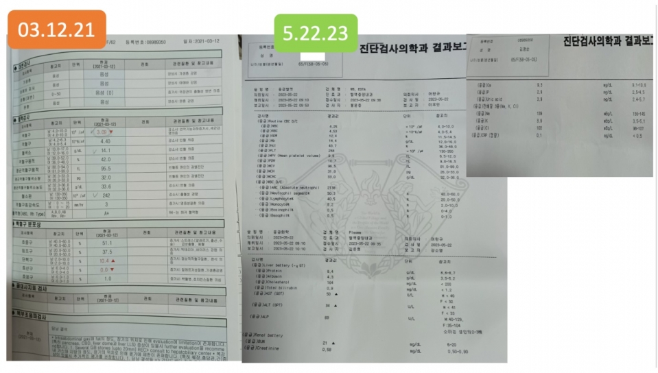 텔로유스,한국 텔로유스,텔로유스 서울,텔로메가,텔로유스 파우더,텔로유스 성분,텔로유스 판매,텔로유스 체험,텔로유스 효능,텔로유스 수례안,텔로유스 가격,텔로유스 판매,텔로유스 백혈구,협착증,1.jpg