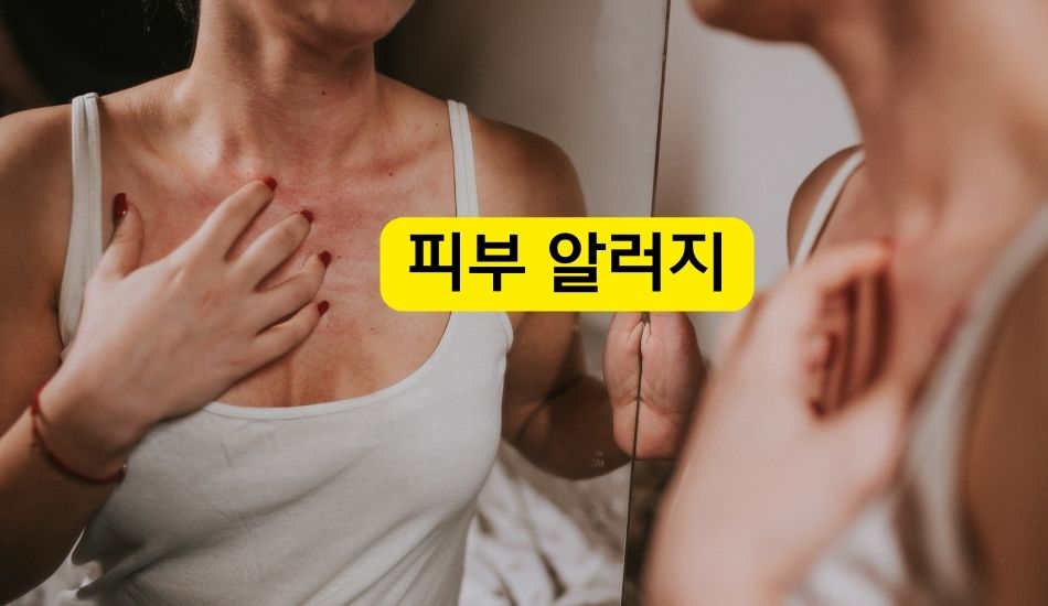 텔로유스,텔로유스 한국,텔로메가,텔로유스 파우더,텔로유스 서울,텔로유스 피부 알러지,텔로유스 피부병,텔로유스 성분,텔로유스 판매,텔로유스 체험,텔로유스 효능,텔로유스 주성분, 텔로유스 가격, 텔로유스 복용,텔로유스 줄기세포,15.jpg