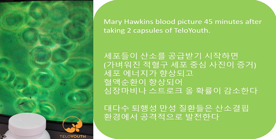 텔로유스,teloyouth,엘에이 텔로유스,텔로유스줄기세포영양제,텔로유스면역력강화,텔로유스 줄기세포영양제,텔로유스 면역력강화,텔로유스 젊음회복,텔로유스 만성피로회복 피검사.jpg